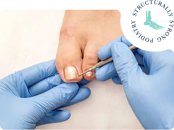 calluses-and-corns