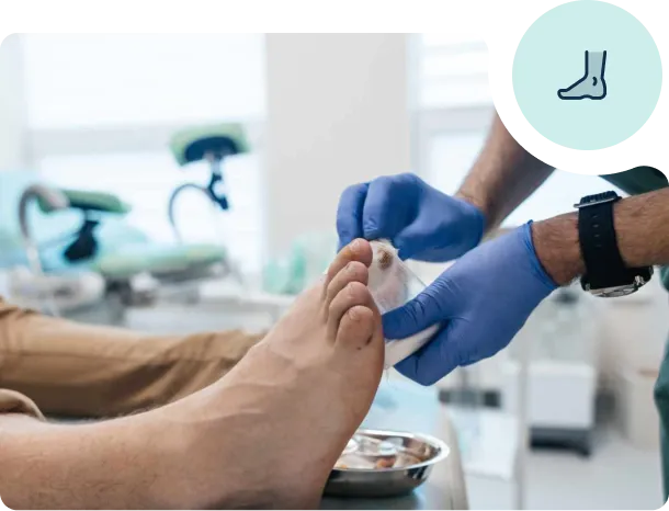 ingrown-toenail